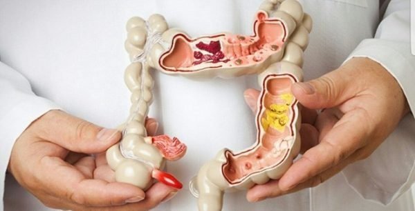 Chữa Lành Cơ Thể Từ Đường Ruột – Bí Quyết Từ Chất Xơ